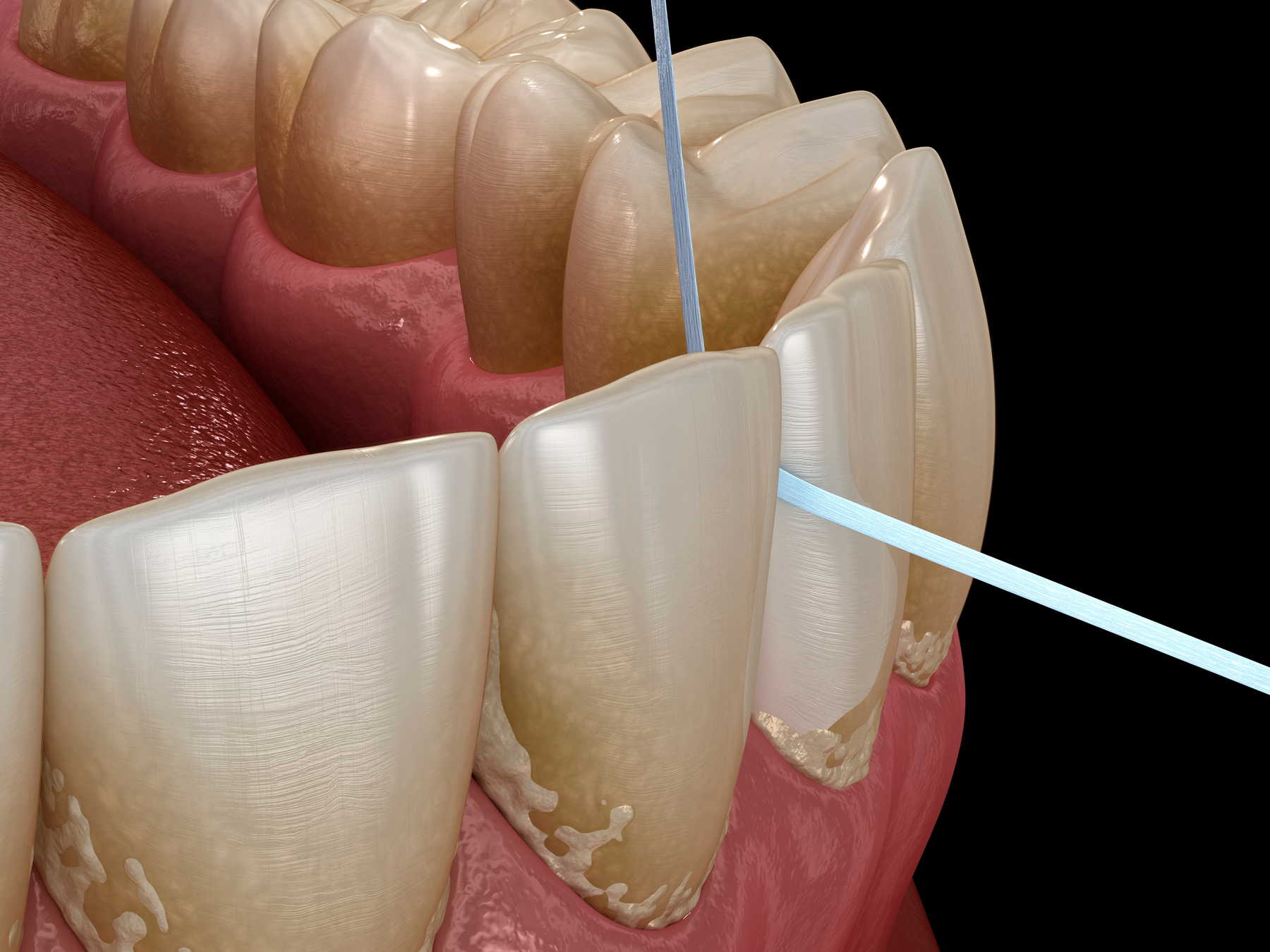 Οδοντιατρικός έλεγχος και καθαρισμός δοντιών